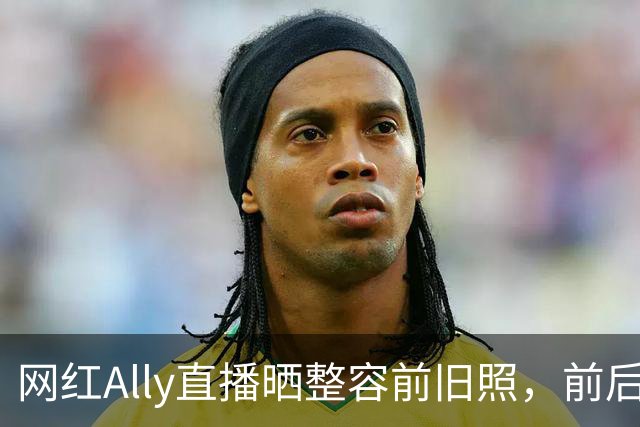 网红Ally直播晒整容前旧照，前后差距巨大，称放出照片要巨大勇气